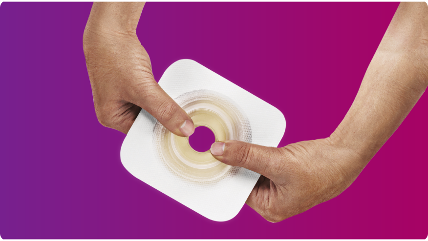 mãos segurando uma placa de base Convatec Mouldable Technology