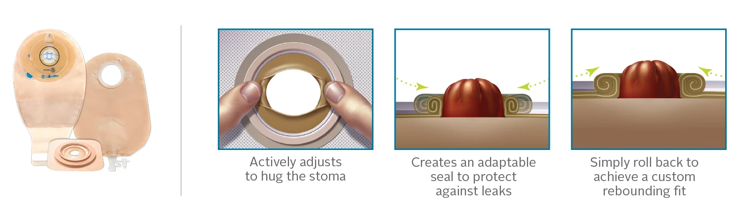 Forma irregular de estoma: imagen del sitio web
