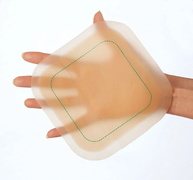 Hand holding a DuoDerm Dressing